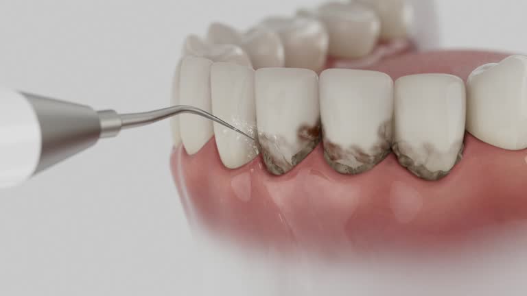 Reliable Tooth Extraction contractor in Carleton, MI by Smile Center Dentistry
